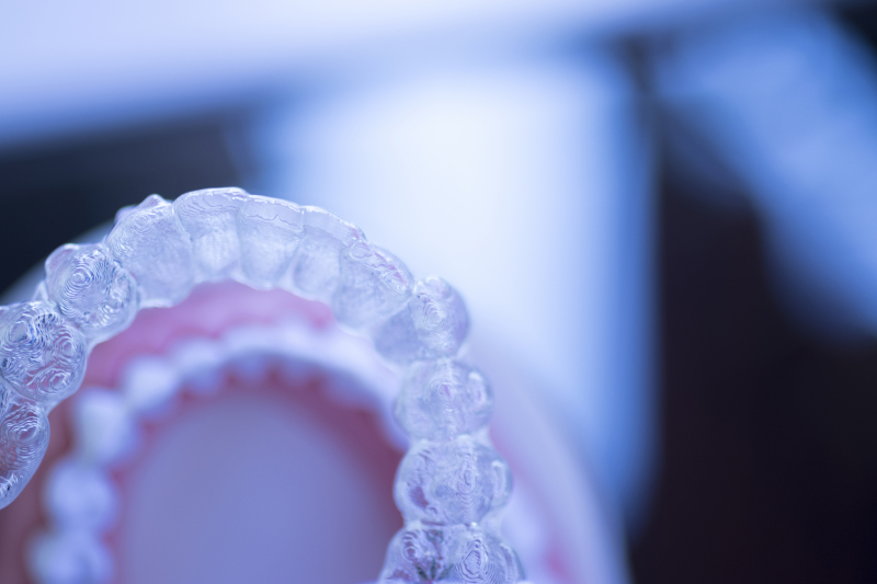 En retainer förhindrar att tänderna återgår till sin ursprungliga position.